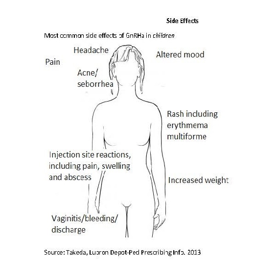 Side effects diagram, showing a female body with a list of symptoms, including headache, pain, altered mood, acne, rash, increased weight, vaginitis. Source, Takeda, Luoron, 2013.